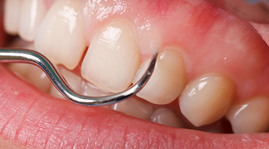 Periodoncia Clínicas Brizuela Díaz